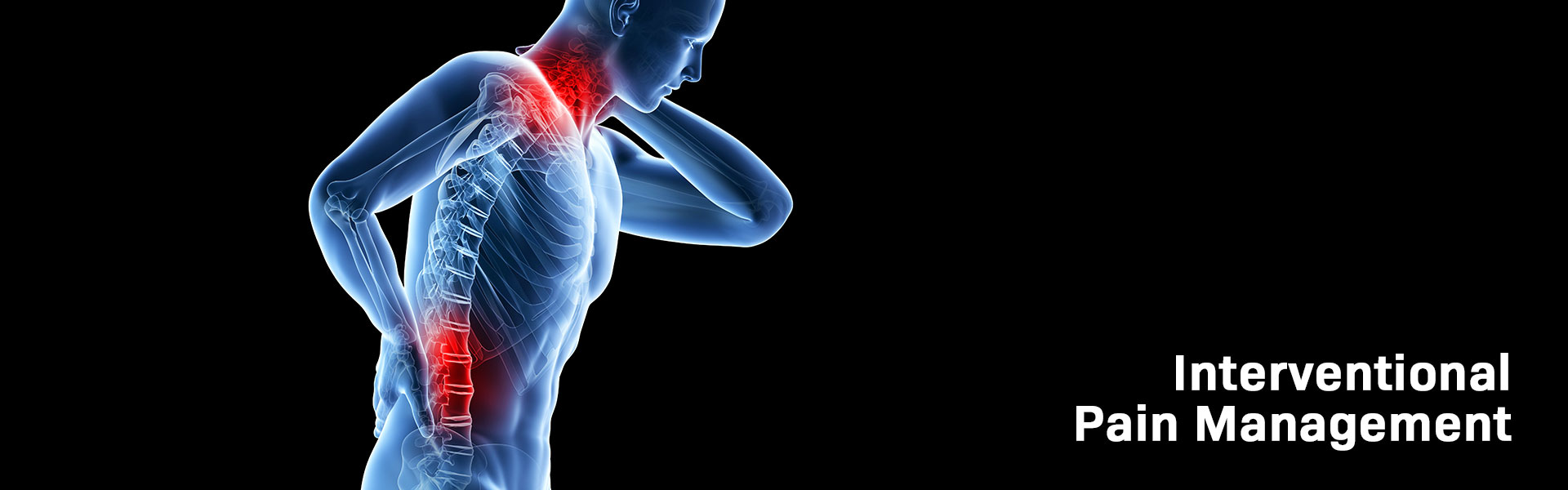 Interventional Pain Management