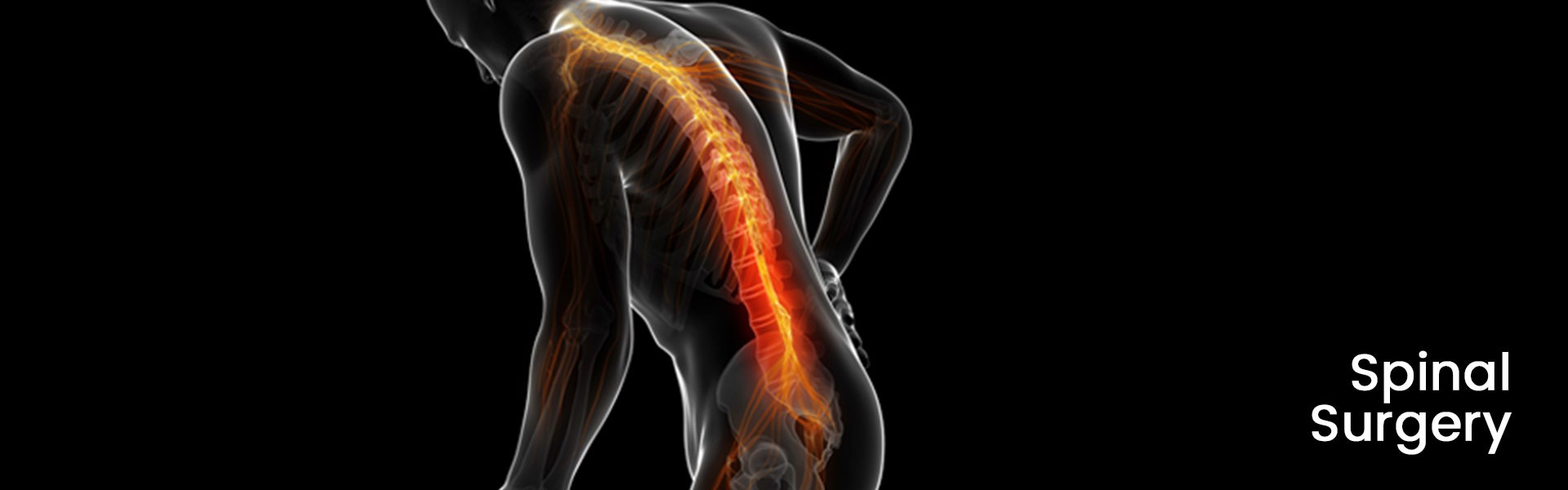 Chattanooga Spinal Surgery Specialists Center For Sports Medicine