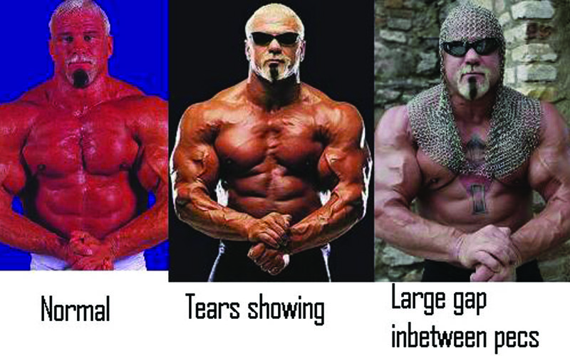 Scott Steiner Has Extreme Pec Separation Not the Good Kind