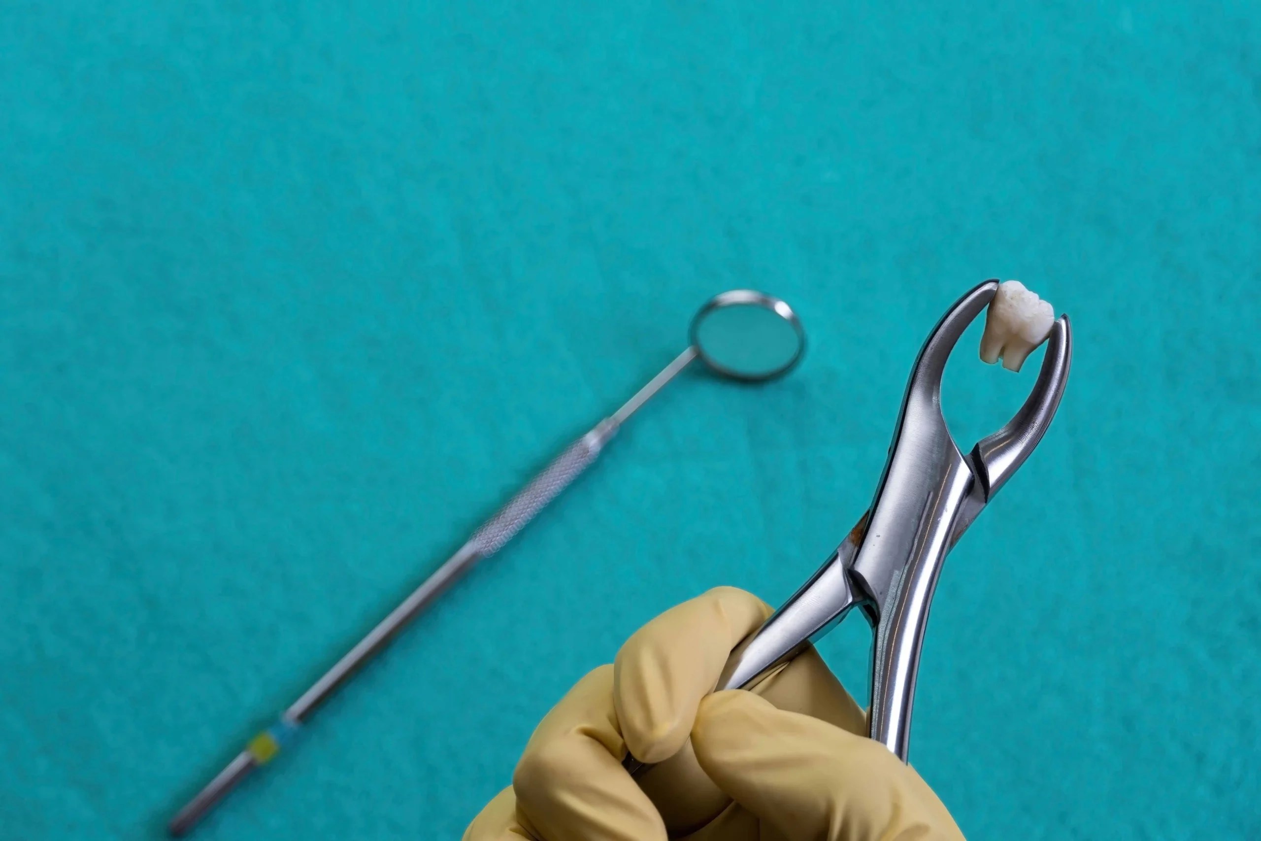 Tooth Extraction Aftercare Tips, Recovery, and Home Remedies