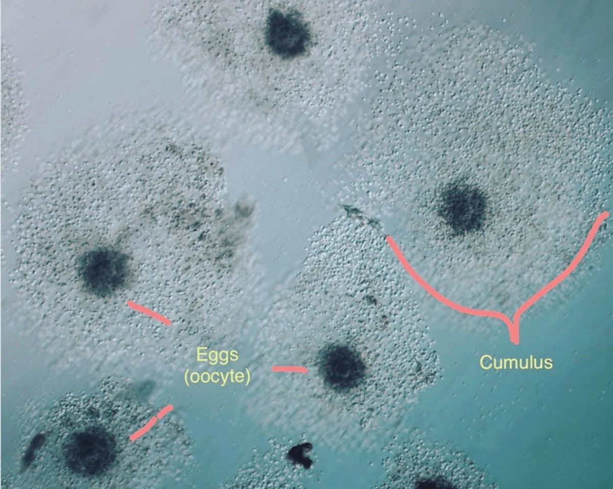 What do eggs look like right after collection? Spring Fertility