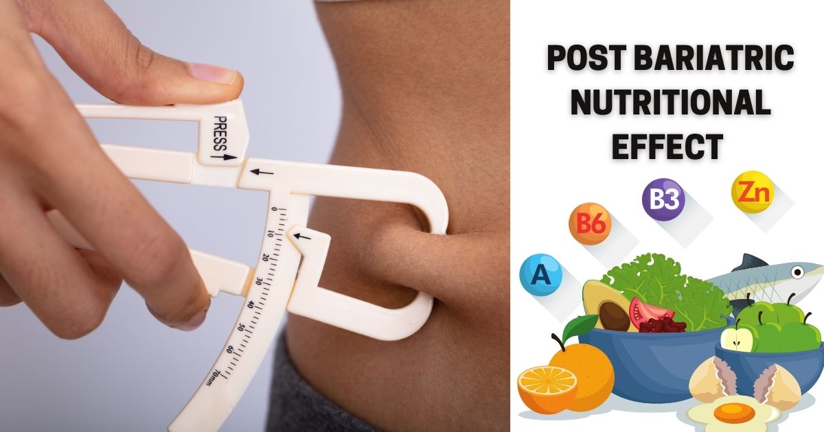 Post Bariatric Nutritional Effect Dr Maran Springfield Wellness