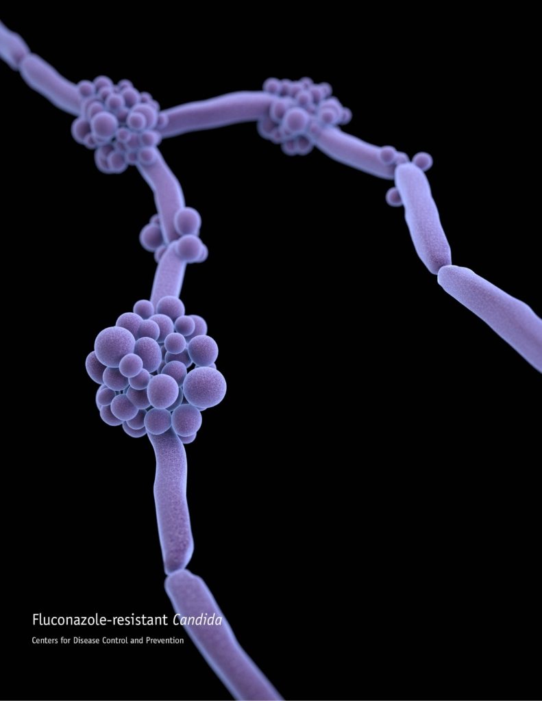 Potentially deadly drugresistant â€˜fungal superbugâ€™ emerging in Canada