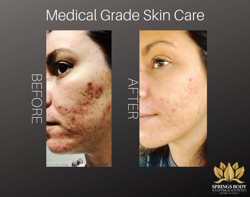Colorado Springs Premier Med Spa Springs Body Sculpting