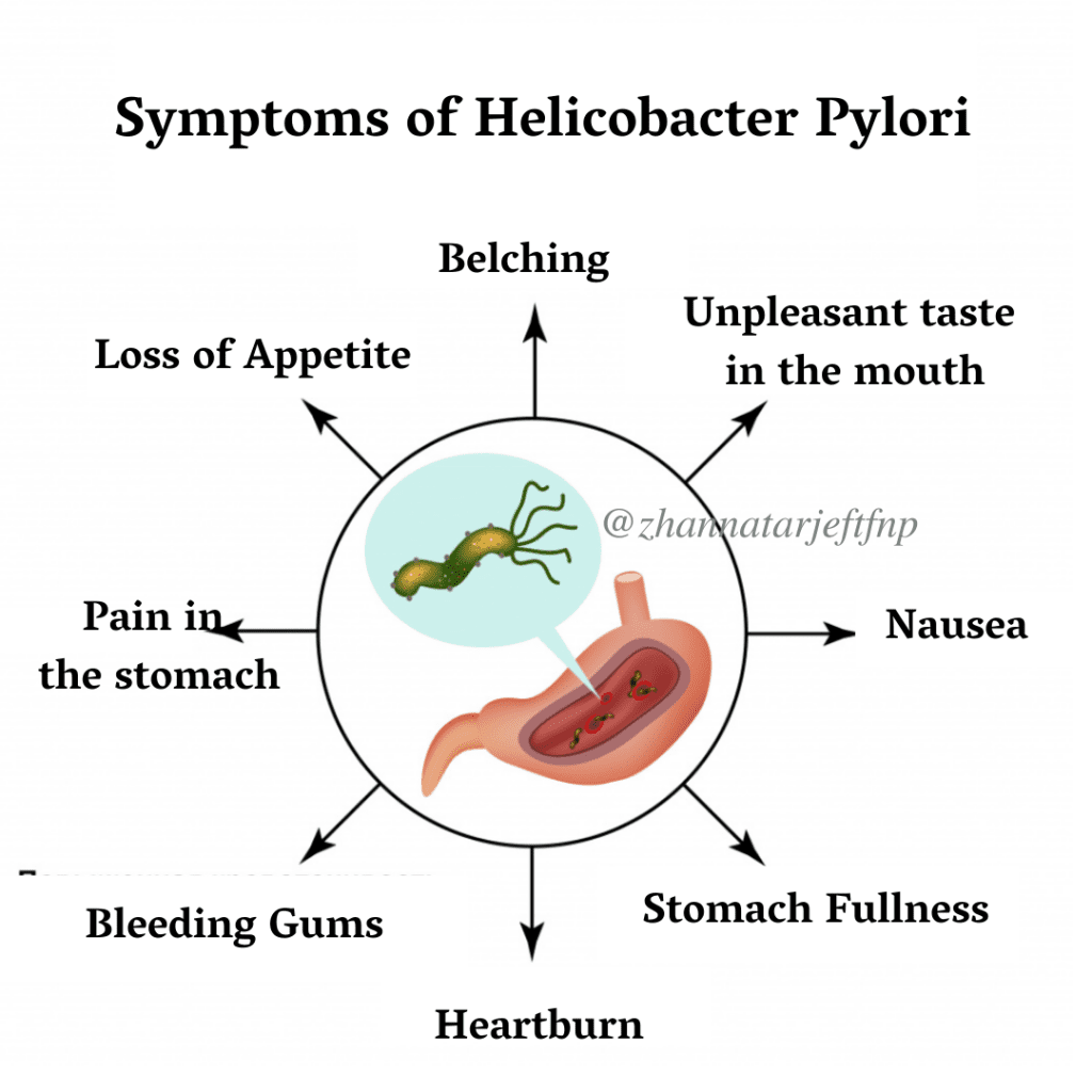 What does helicobacter pylori cause? Explained by FAQGuide