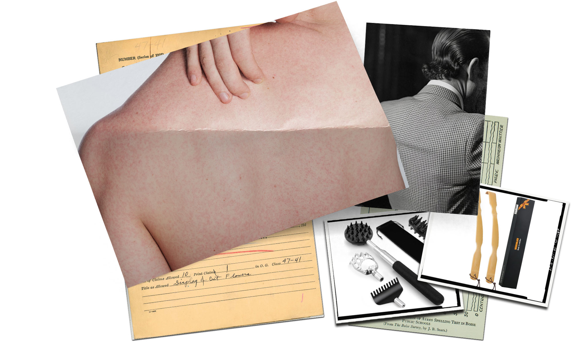 The Best Back Scratchers, According to Dermatologists SPY