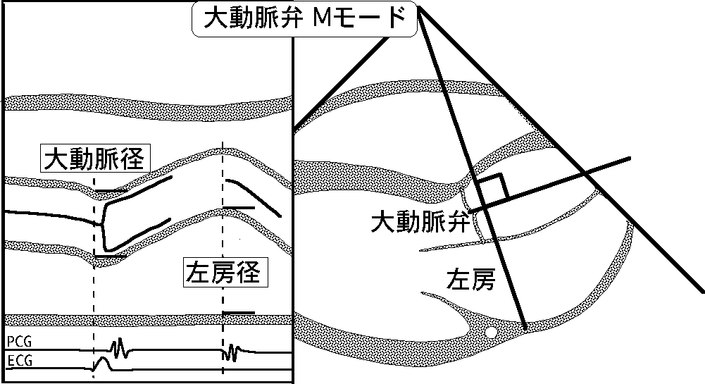 基本断面（胸骨左縁大動脈弁）