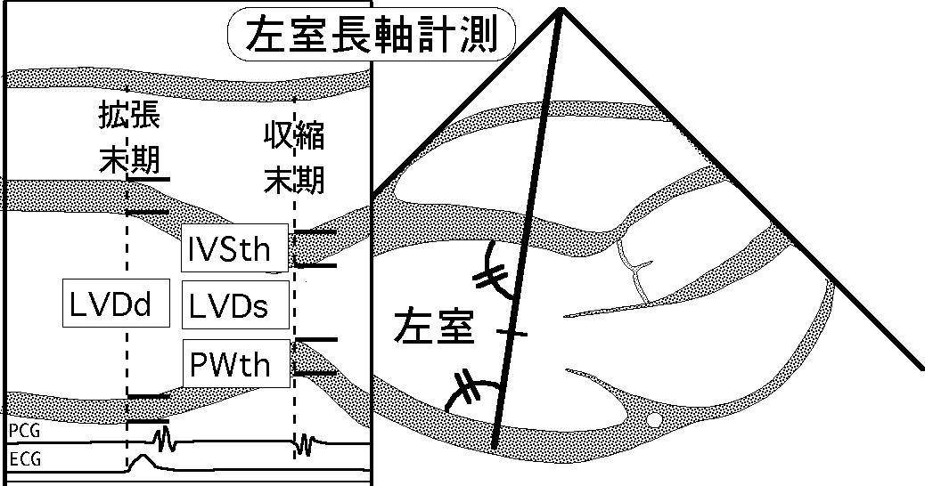 基本断面（胸骨左縁左室長軸計測）