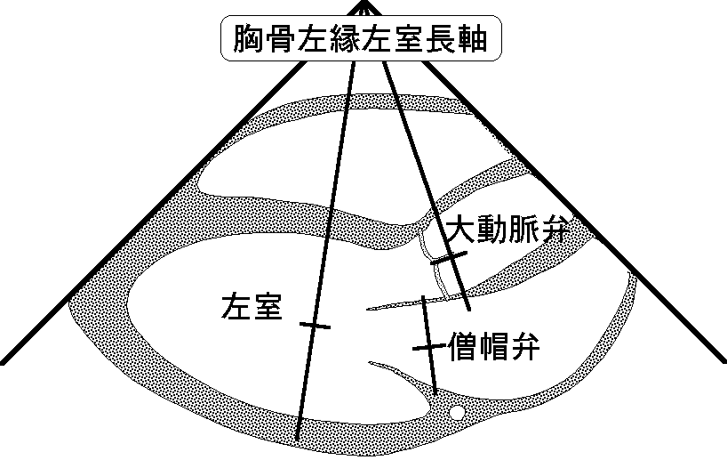 基本断面（胸骨左縁左室長軸）