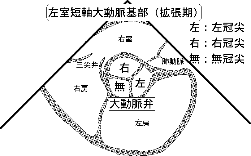 基本断面（胸骨左縁 左室短軸大動脈基部）