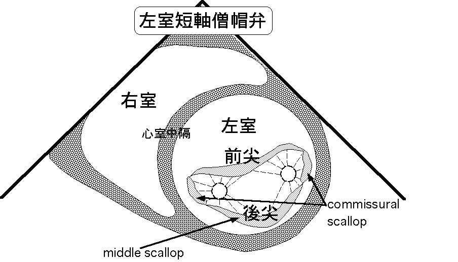 基本断面（胸骨左縁 左室短軸僧帽弁）