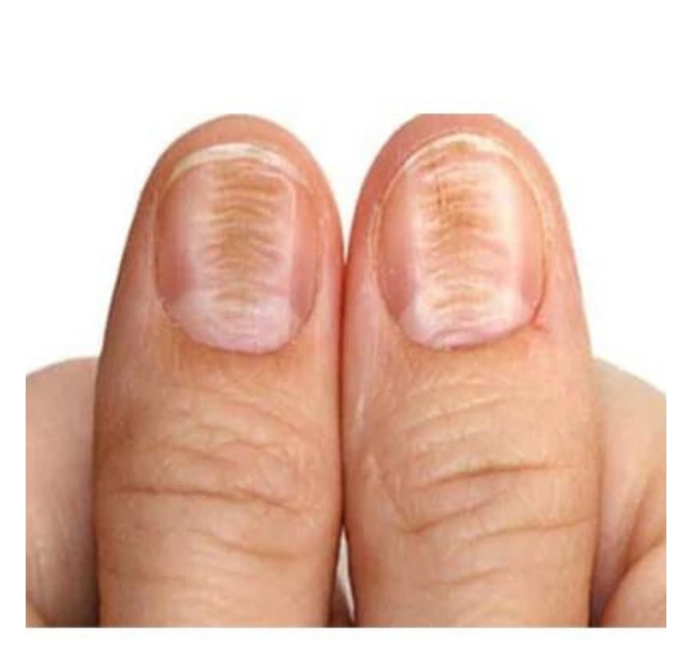 Why Do We Have Fingernails? Most Surprising Reasons!