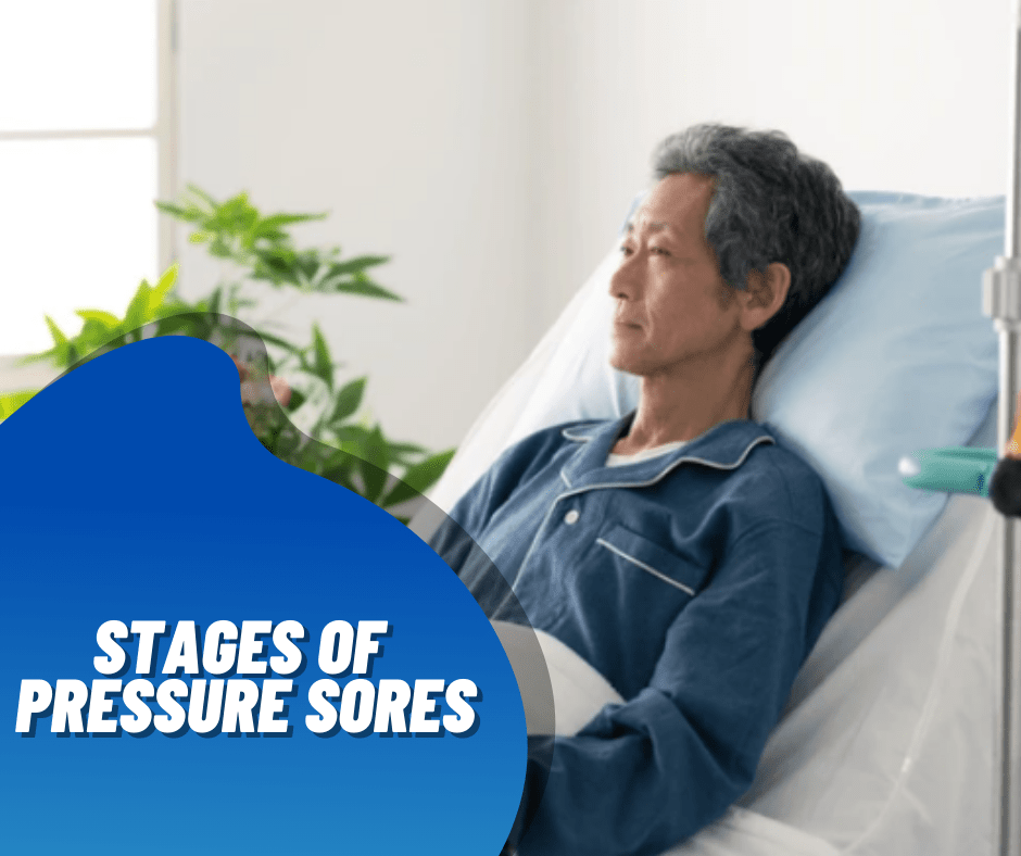 Elderly Pressure Sores Prevention and Treatment SR Parents