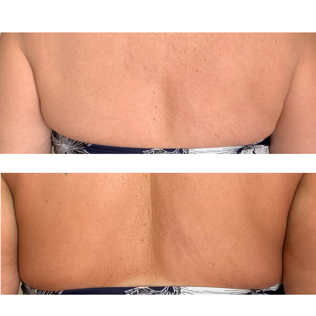 Spray Tan SR Beauty Studio