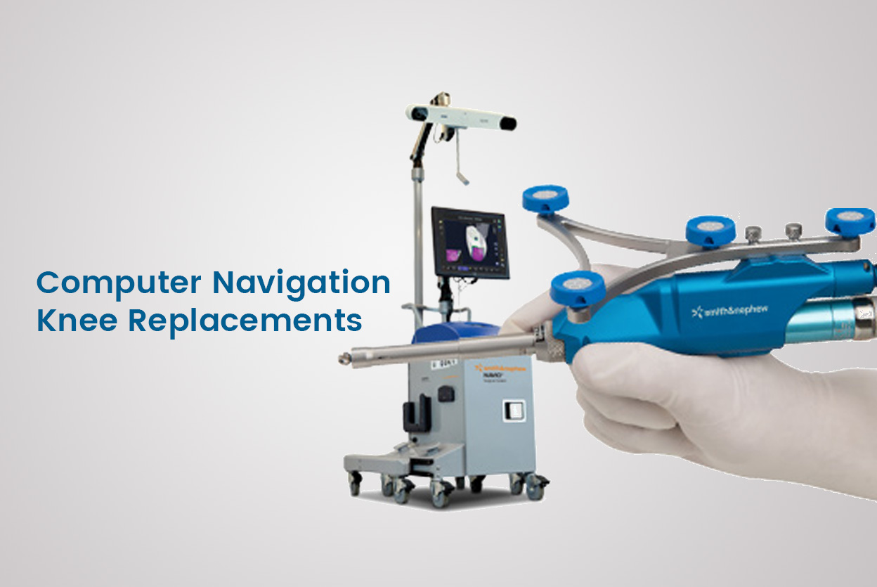 Best Hospitals in RTC Crosss Roads Best Orthopedic Hospitals Miyapur