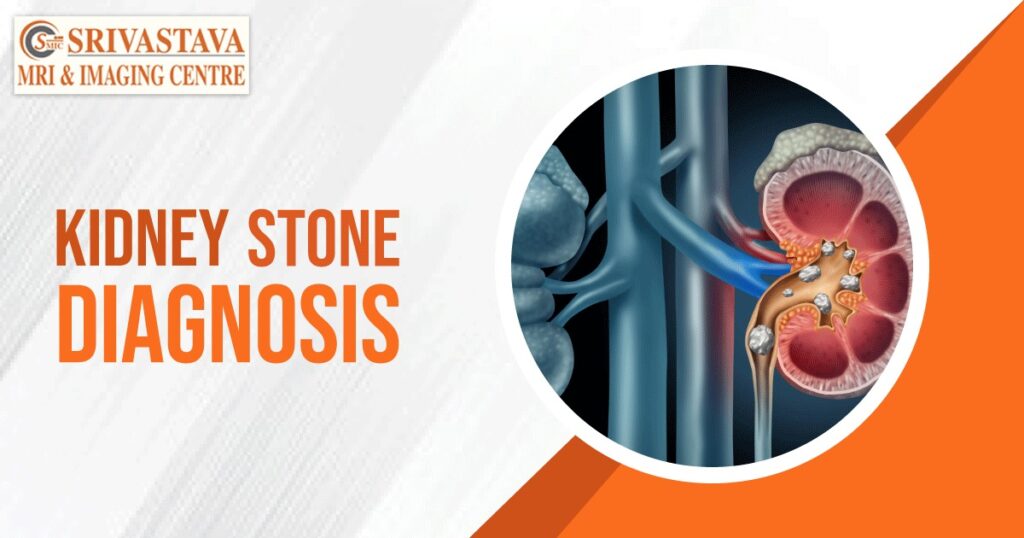 Diagnosis methods for Kidney stones srivastavamriandimagingcentre