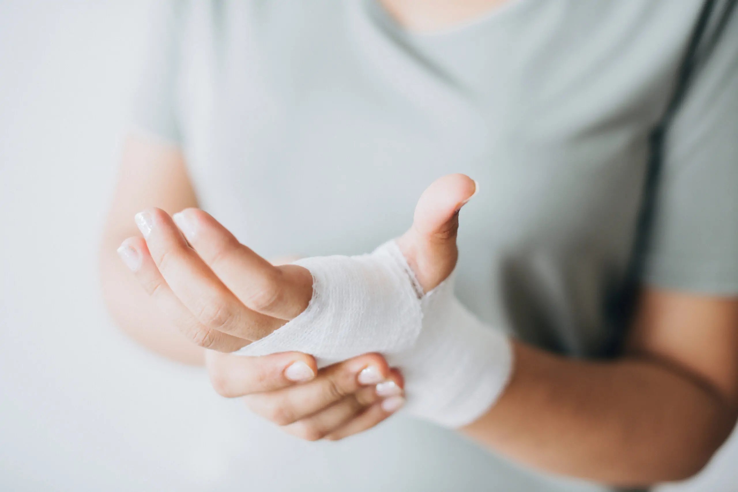 Hand Fractures healing a broken hand Santa Rosa Orthopaedics
