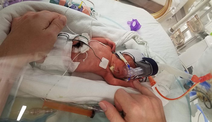 Teamwork is delivering powerful changes for newborns SSC