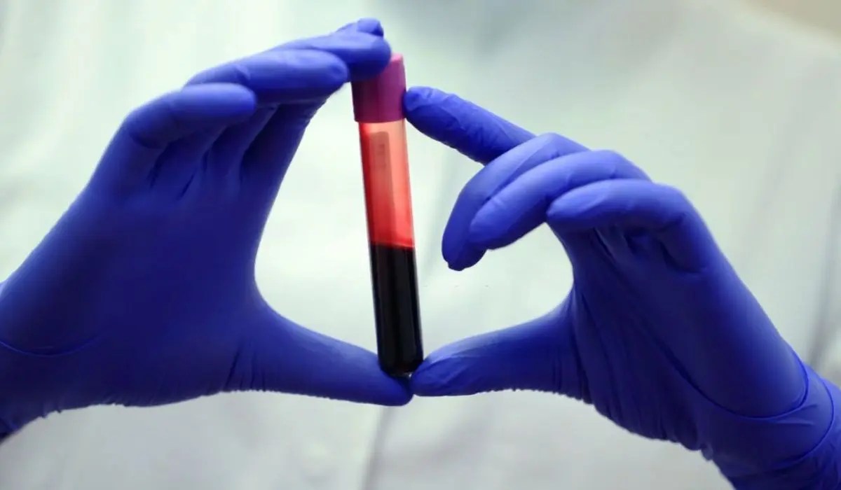 What Type Of Cancer Causes Low Hemoglobin?