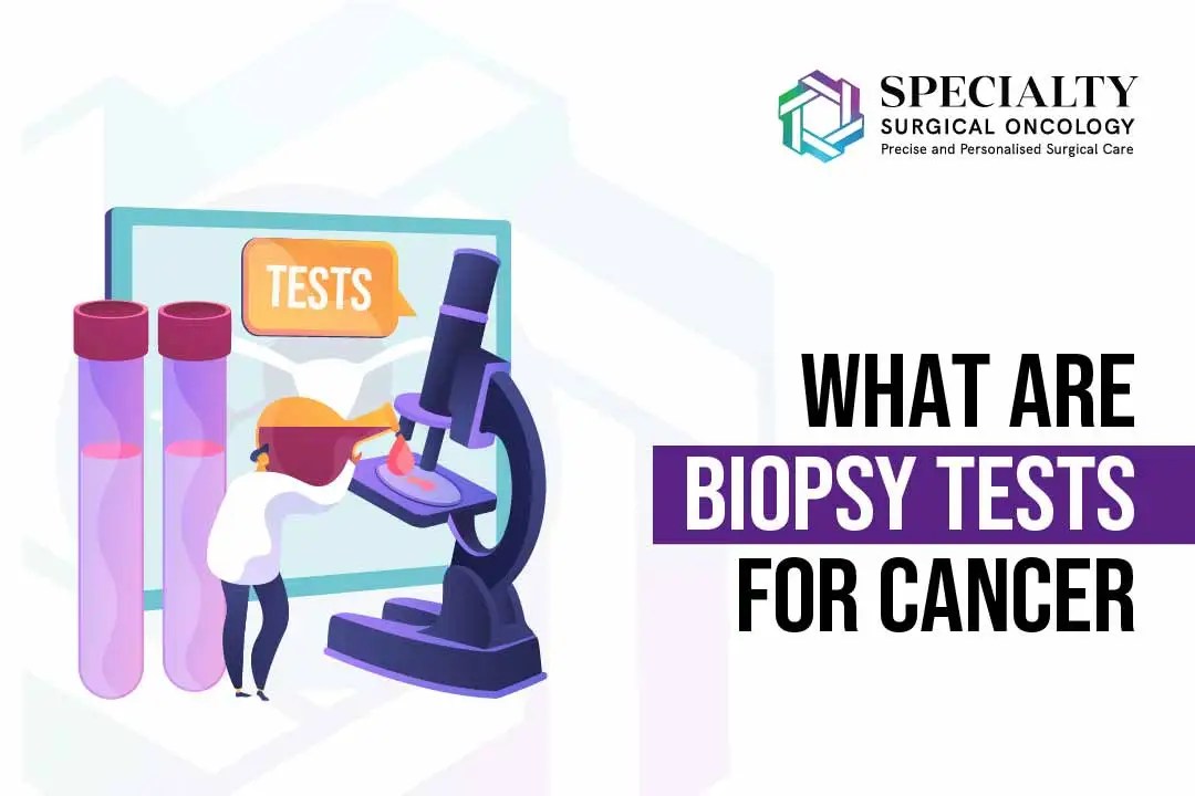 What Is Biopsy? Types & Results SSO Hospital