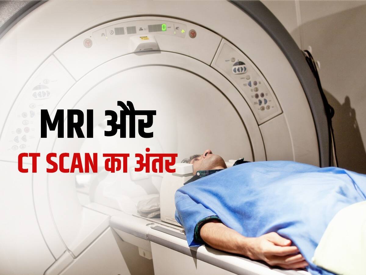 किन कारणों से किया जाता है MRI और कब पड़ती है CT Scan की जरूरत, जानें दोनों का अंतर