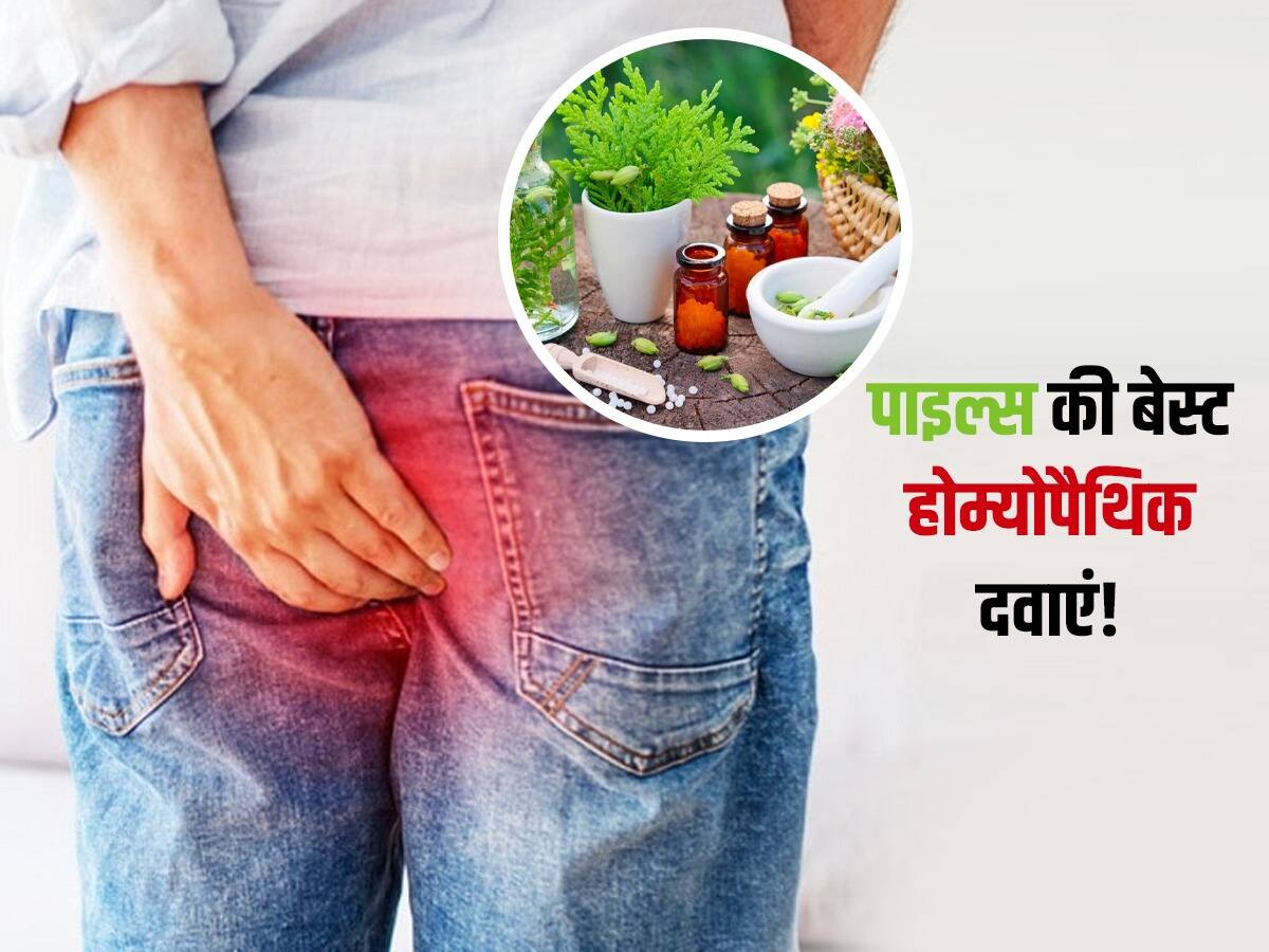Homeopathic medicine for piles खूनी या बादी ये 5 दवाएं बवासीर में