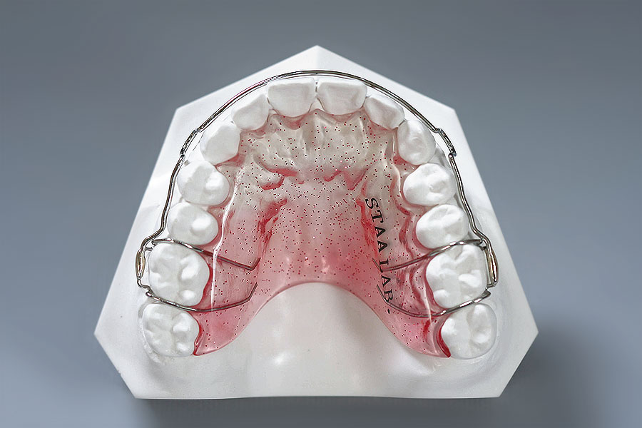 MOD Retainer Adam’s clasp solder STAALAB