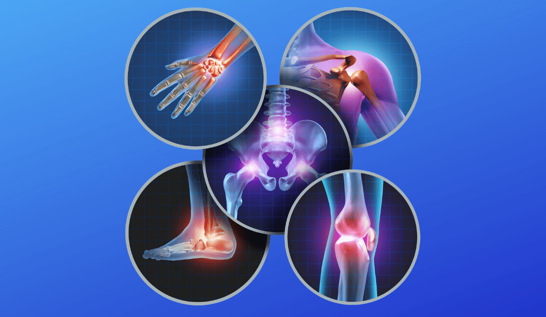 Top Orthopedic Companies in the United States iData Research
