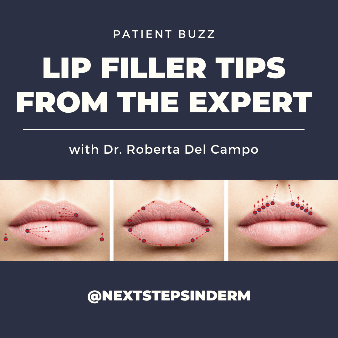Patient Buzz Lip Filler Tips From the Expert Next Steps in Dermatology