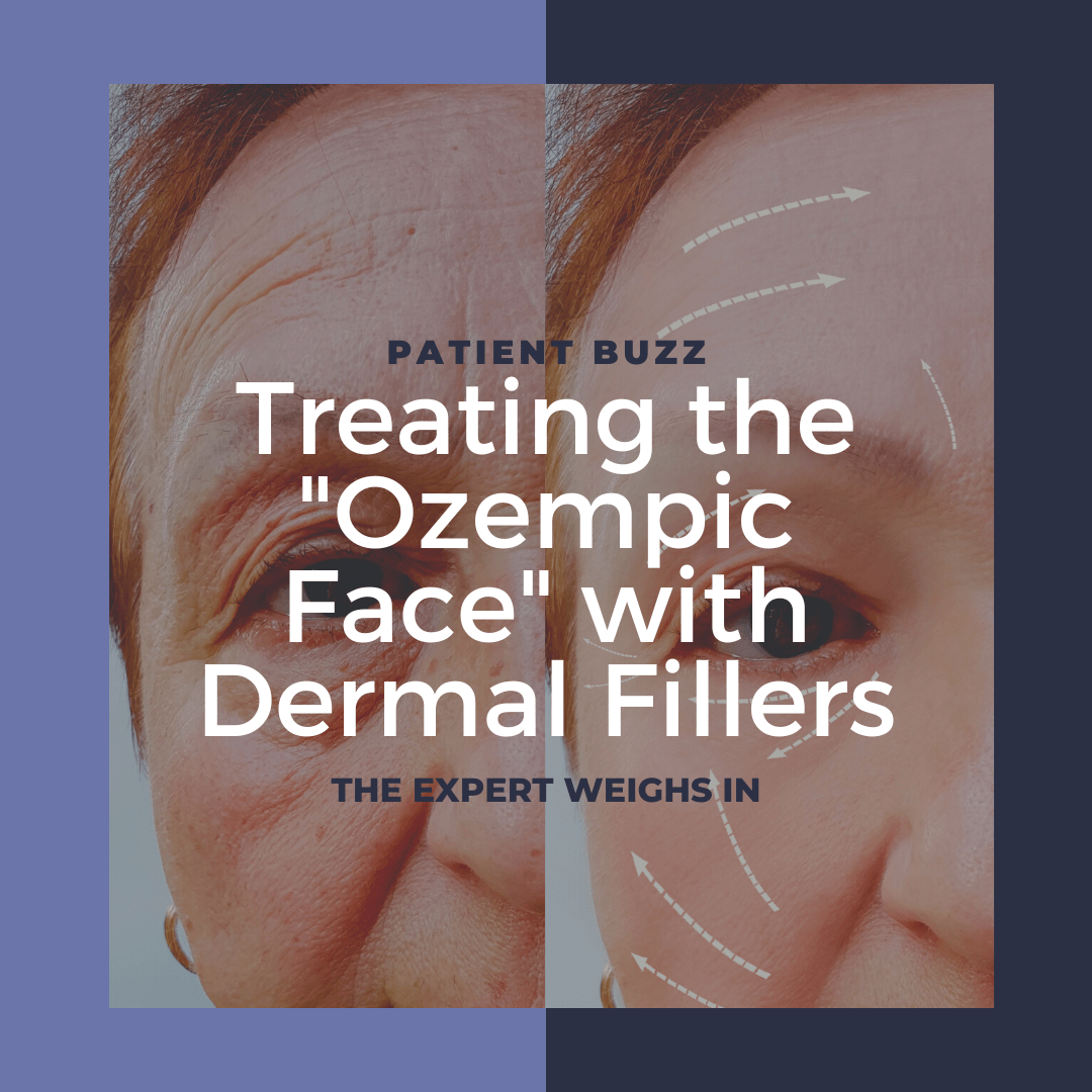 Treating the "Ozempic Face" with Dermal Fillers Next Steps in Dermatology