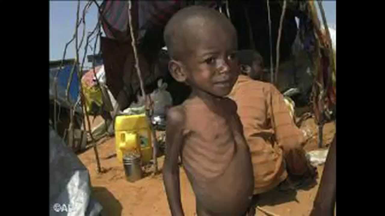 La fame nel mondo. Una pestilenza silenziosa. STAMPACRITICA