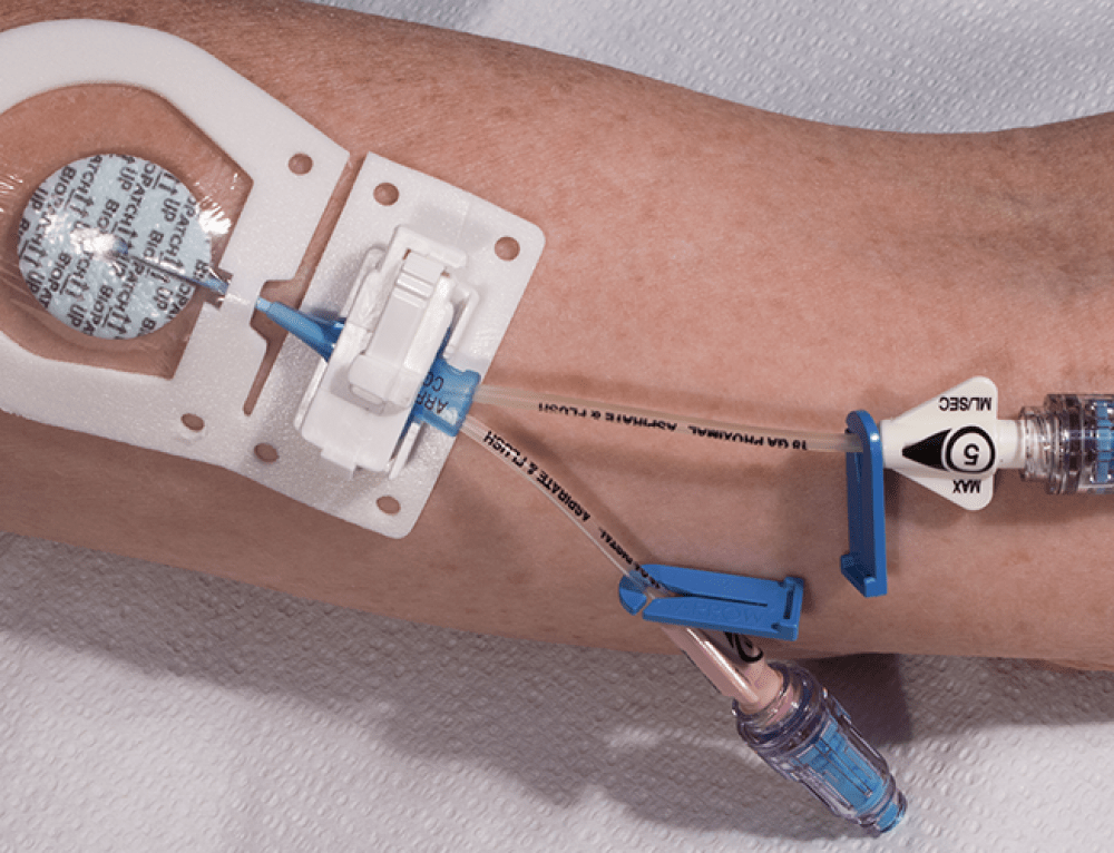 Starboard Medical Showcases ClikFIX™ All ‘n One Peripheral Catheter