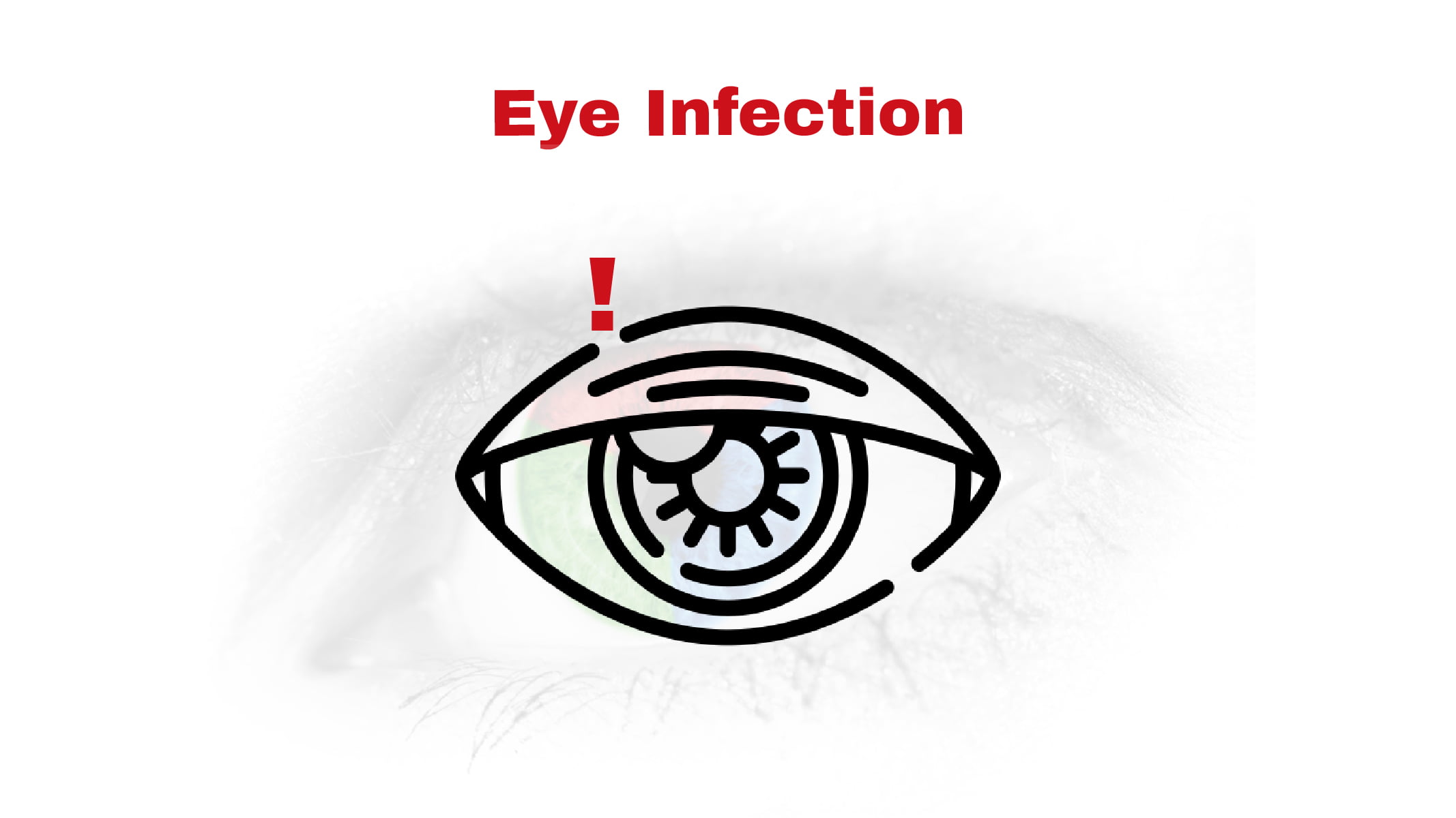 Eye Infection Stat Cardiologist