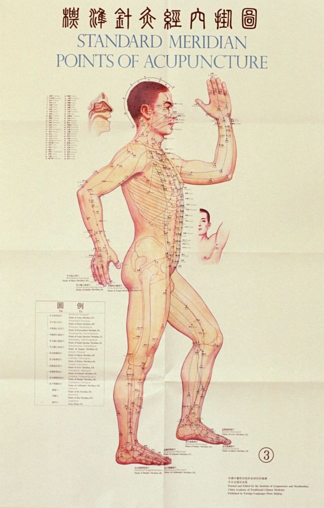 Acupuncture for Weight Loss What You Need to Know StyleCaster