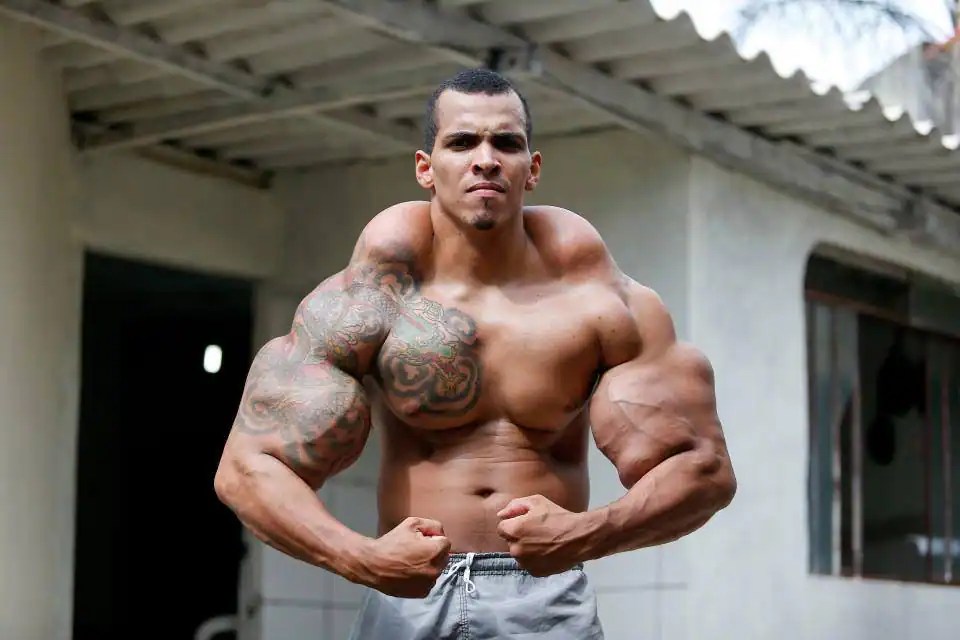 Brazilian bodybuilder Romario injects mineral oil into muscles to get