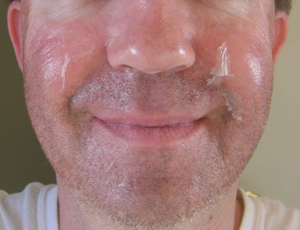 20120612 Day 4 Full Face No 1 Scar logs