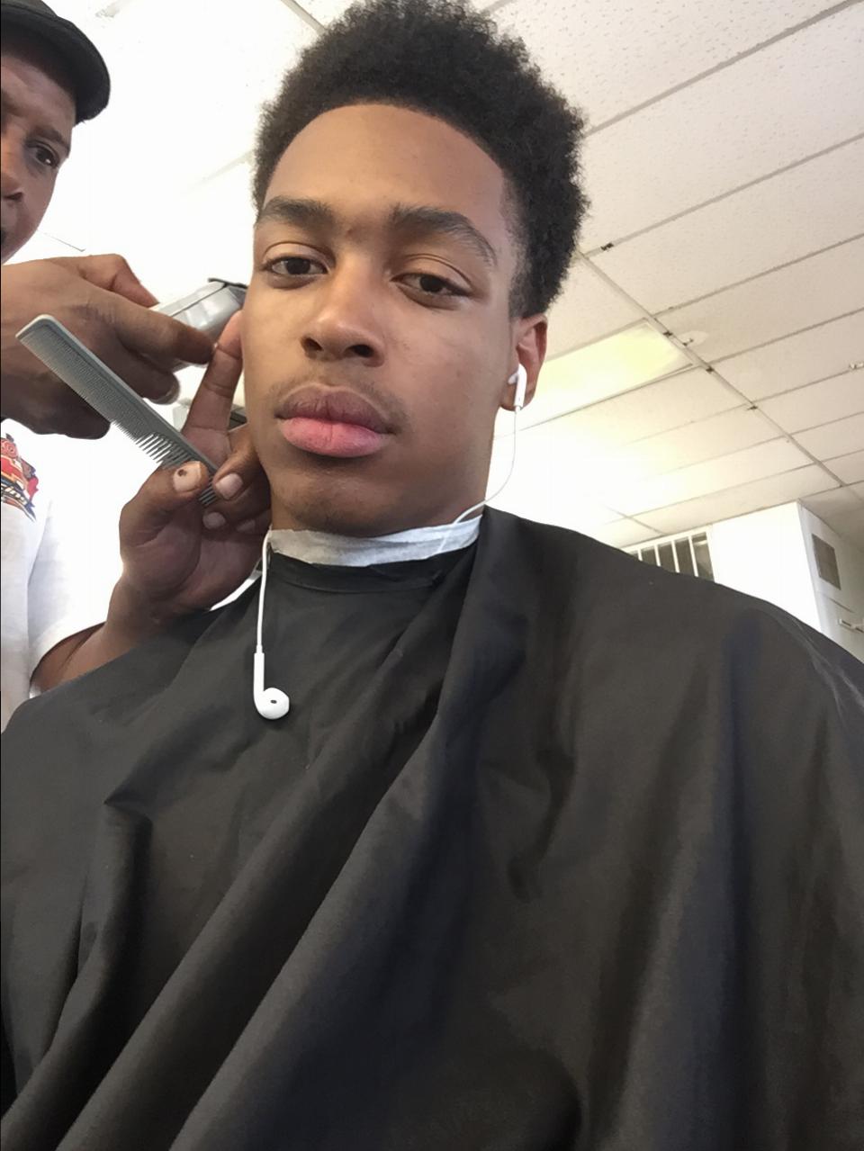 Blackhead scars between Eyebrows Scar treatments