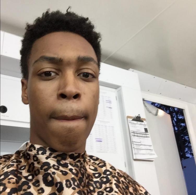 Blackhead scars between Eyebrows Scar treatments Forum