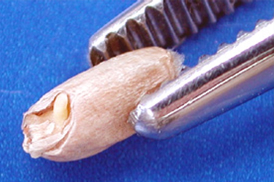 Grain grading guide to tighten definition of 'severely' sprouted wheat