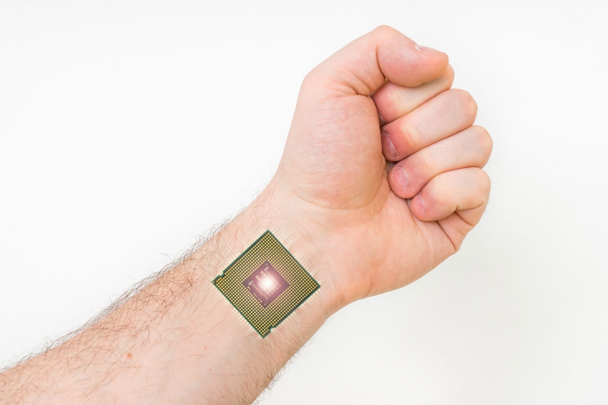 [SPT 168] Chip pod skórą to szybkość i wygoda. Wszczepię go sobie