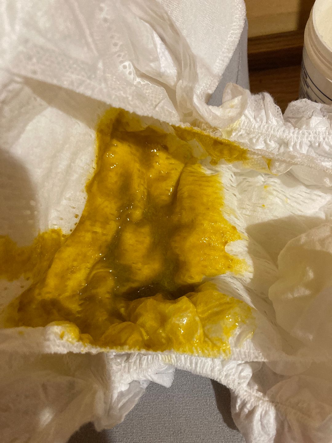 Constant diarrhea 2 mo BabyCenter