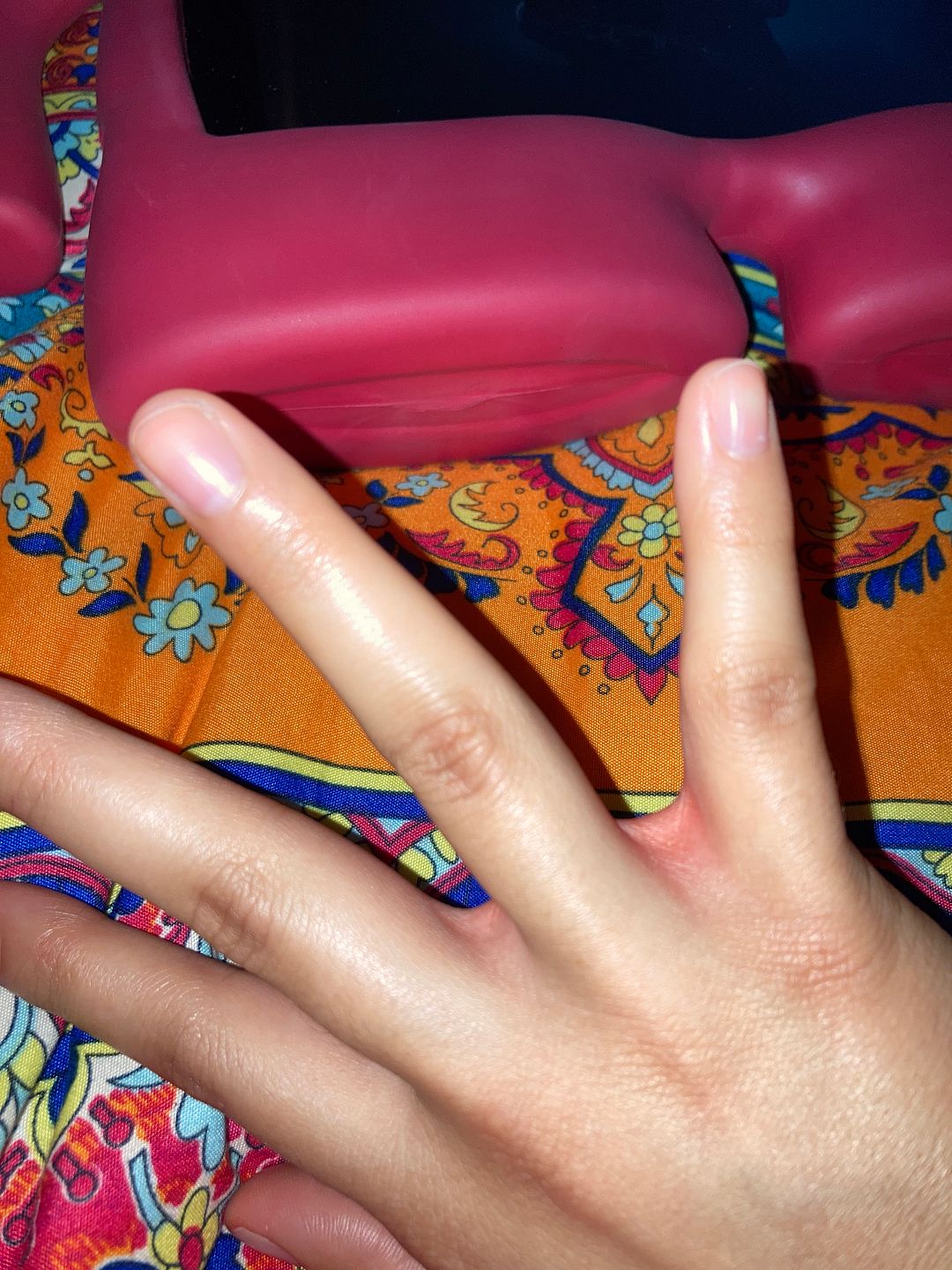 Numbness/swelling in hands and bright redness in between my fingers