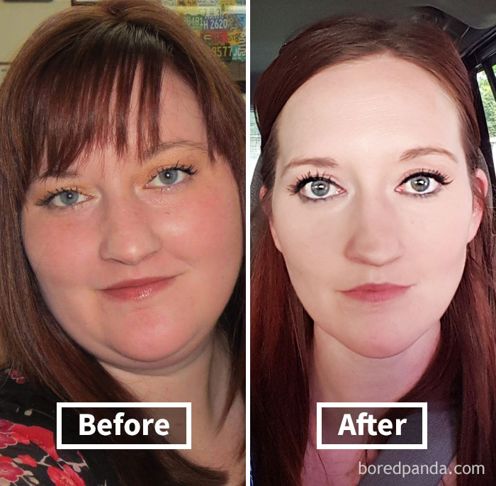 128 Surprising Photos of Face Fat Loss Before and After Weight Loss