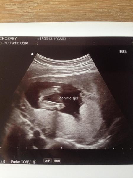 14/15 Weken Baby's Weten Jullie Het Geslacht Al?? | Zwangerschapsforum