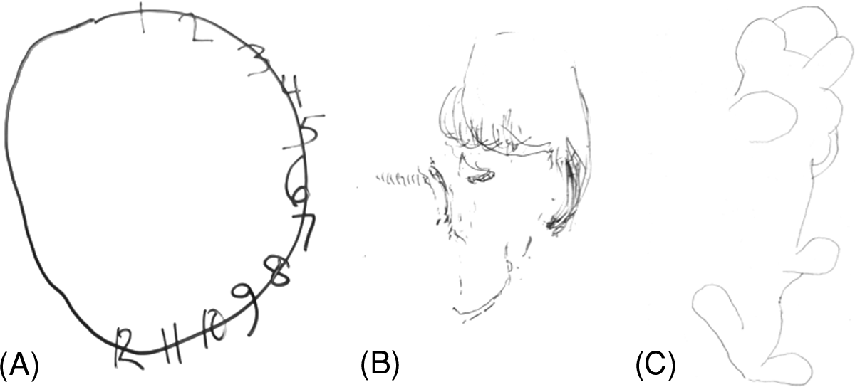 A score of 26 or over is considered to be normal. Neurobehavioral And Neuropsychiatric Assessment Section Ii Behavioral Neurology Neuropsychiatry
