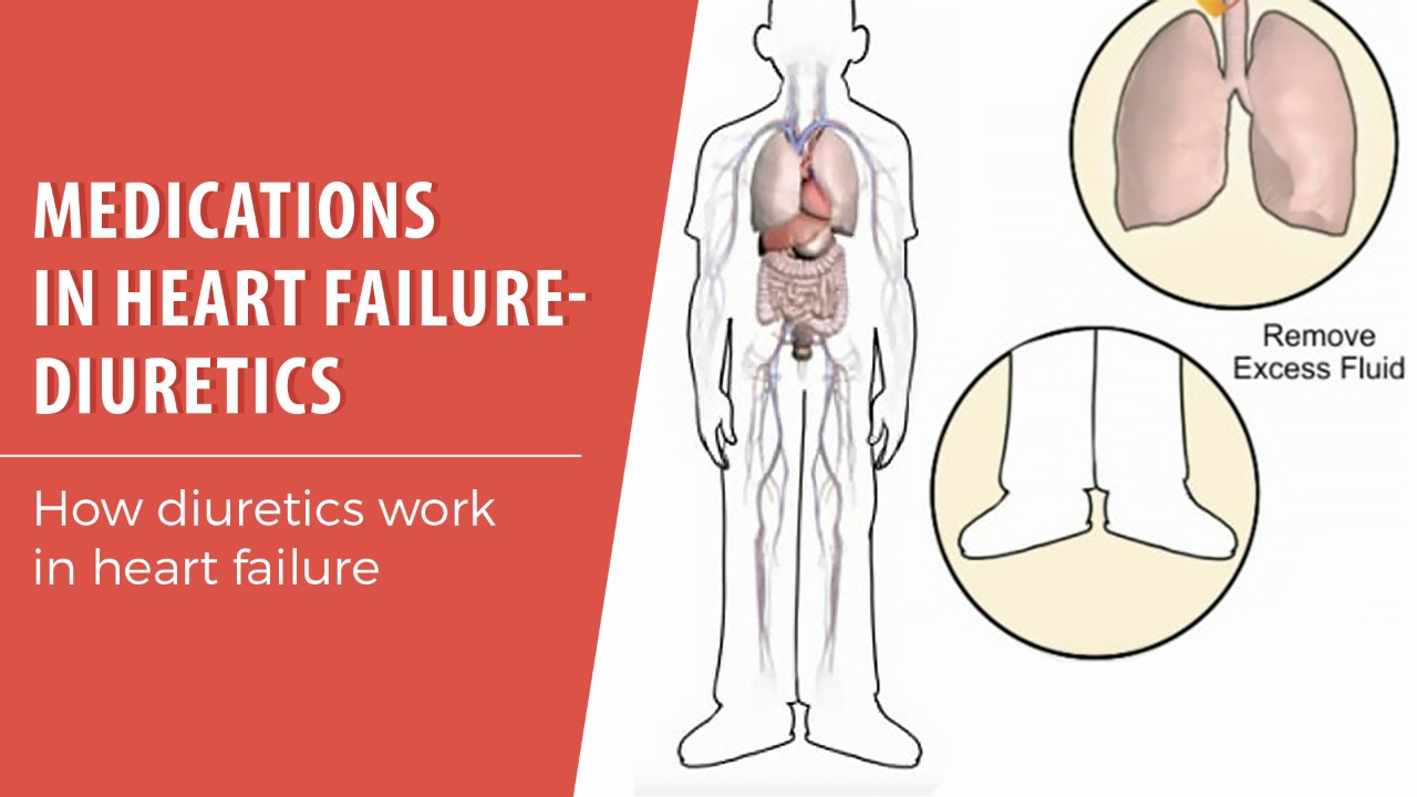 How Heart failure causes fluid build up Advanced Cardiology of