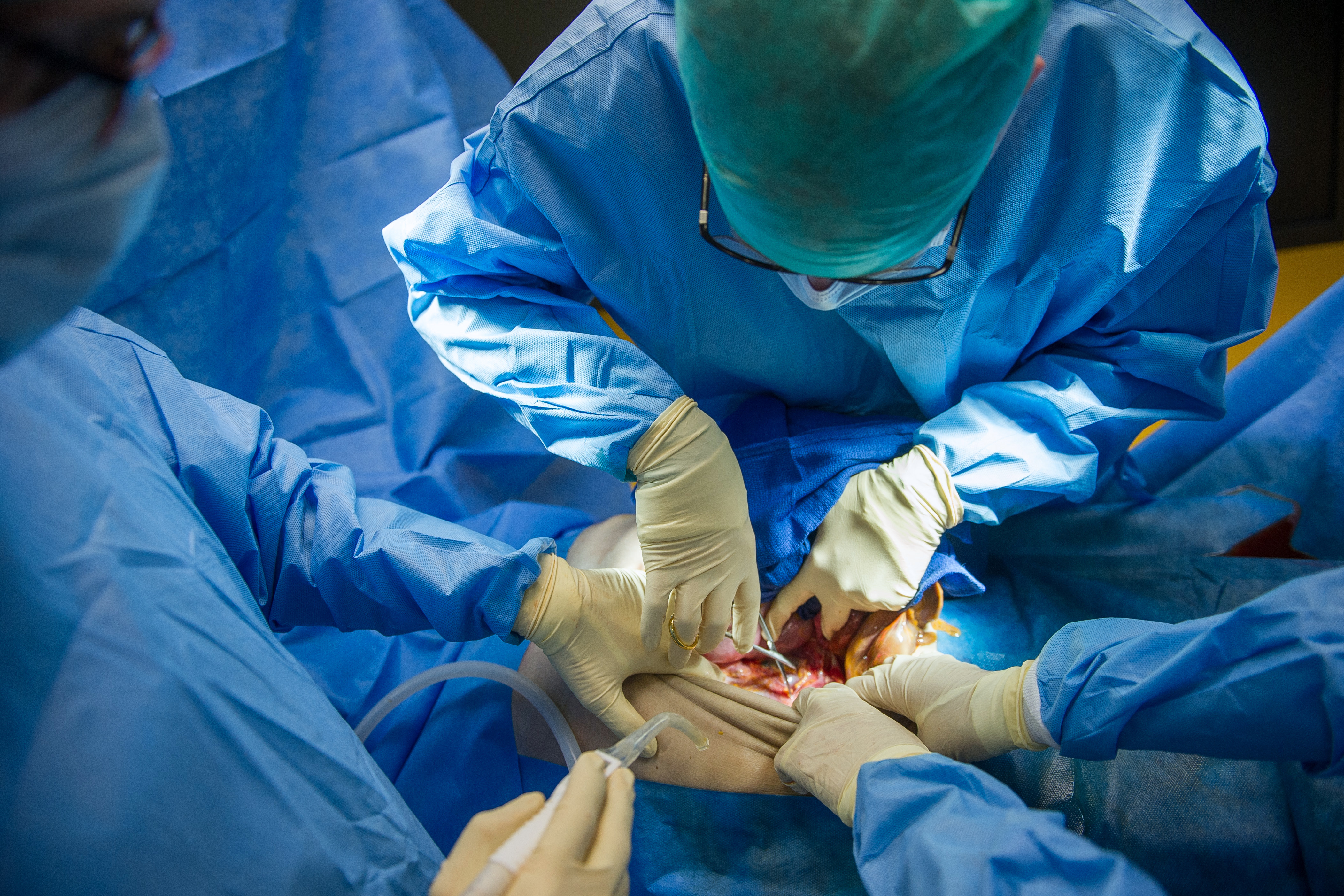 Erreur médicale l'anesthésiste se trompe de produit, une femme