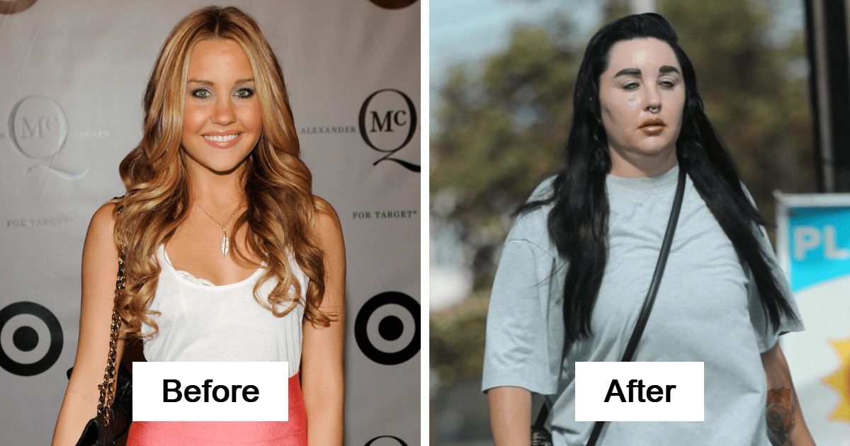 15 Shocking Celebrity Transformations That Made Headlines This Year