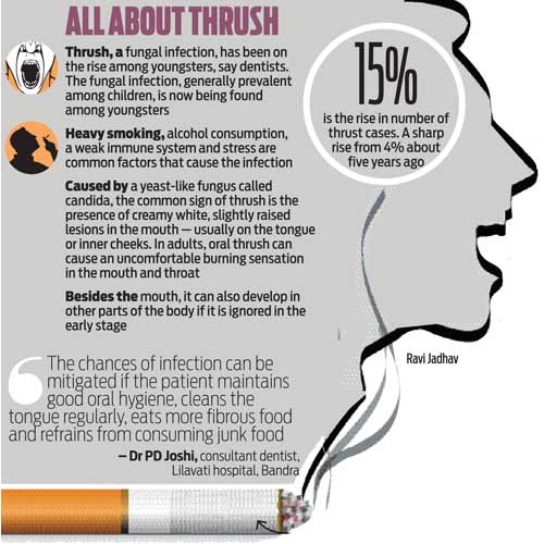 Oral thrush from smoking