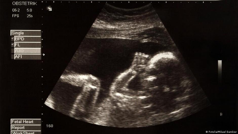 Scientists sequence fetus DNA Home DW 11.06.2012